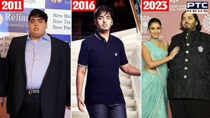 Anant Ambani's Health Concerns: A Detailed Examination
