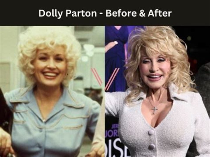 Are Dolly Parton's Boobs Natural Or Enhanced: Uncovering The Truth