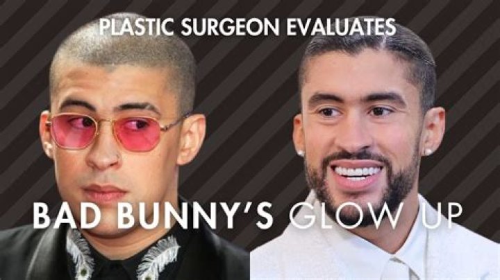 Bad Bunny Before And After Surgery