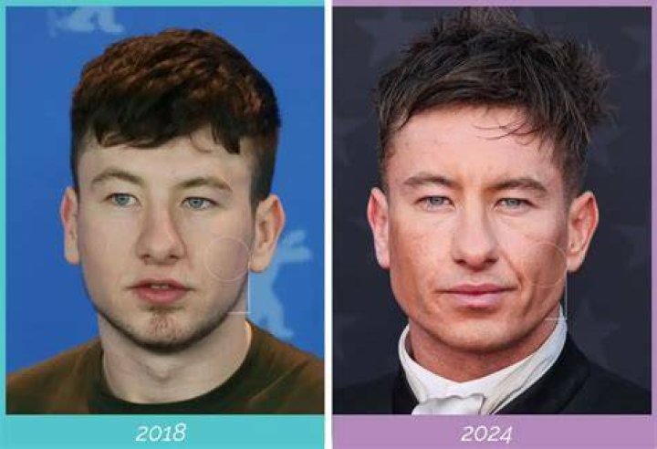 Barry Keoghan: Unraveling His Ancestry