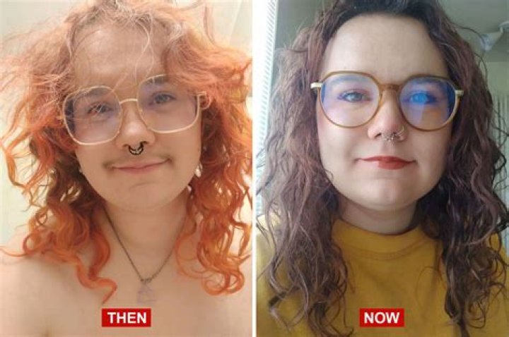 Before And After Her Transition