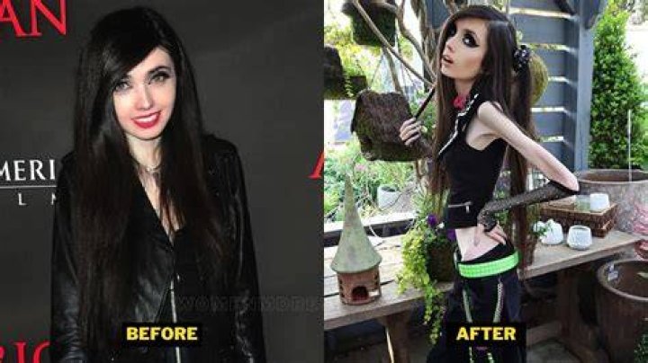 Before And After Of Eugenia Cooney: A Shocking Transformation