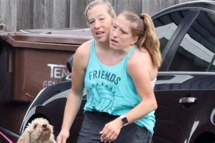 Behind The Scenes Of Brittany And Abby Hensel's Sex Life