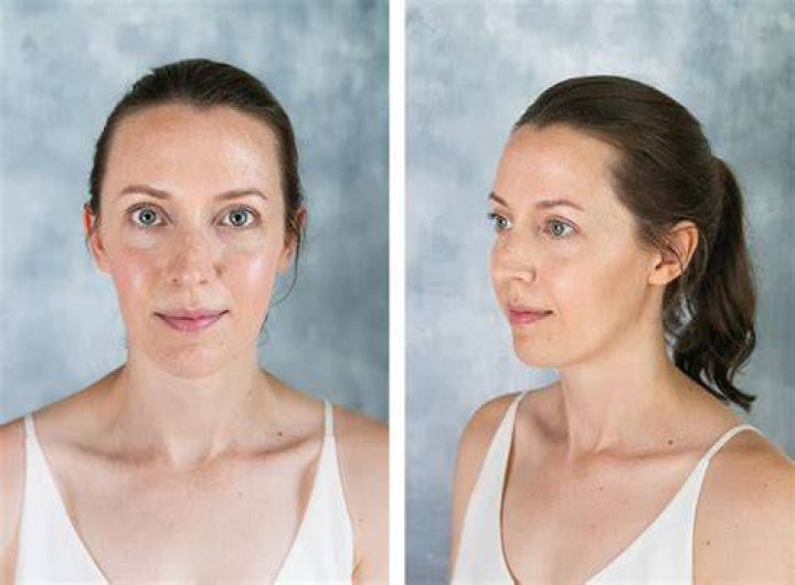 Blair White's Transformation: Before And After Surgery