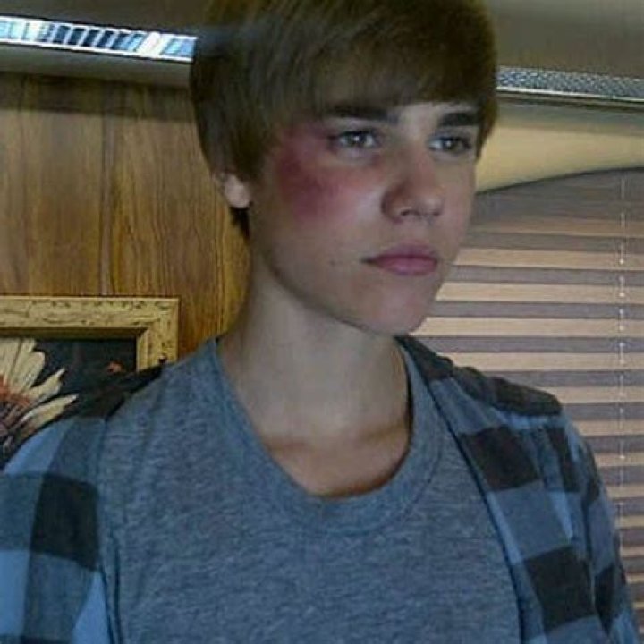 BREAKING: Justin Bieber Rushed To Hospital After Tragic Accident