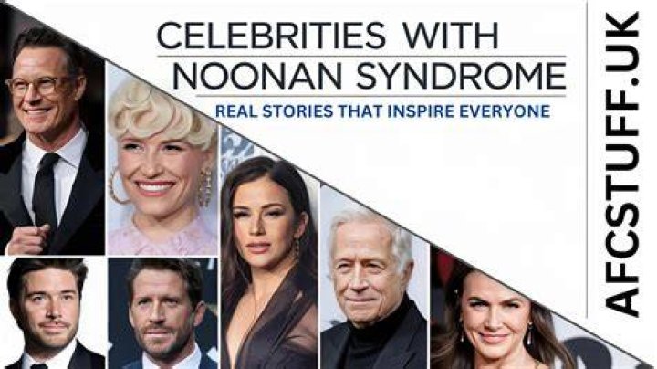 Celebrities With Noonan Syndrome: Notable Individuals And Their Success
