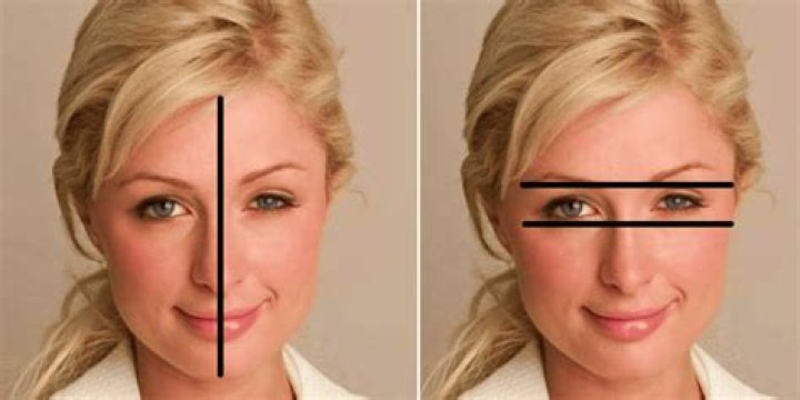 Celebrities With Remarkably Asymmetrical Features