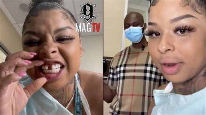 Chrisean Rocks Missing Tooth: What Really Happened