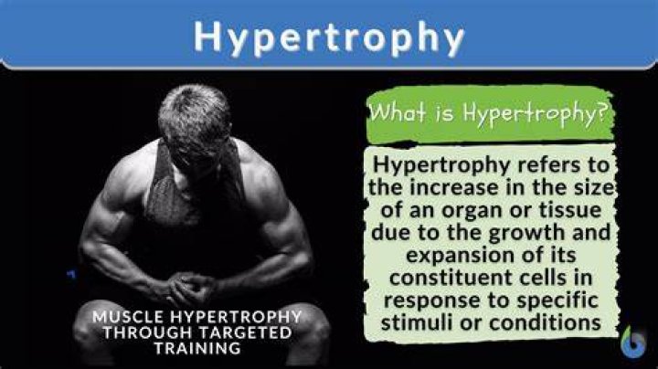 Comprehensive Guide To Facet Hypertrophy: Definition And Beyond