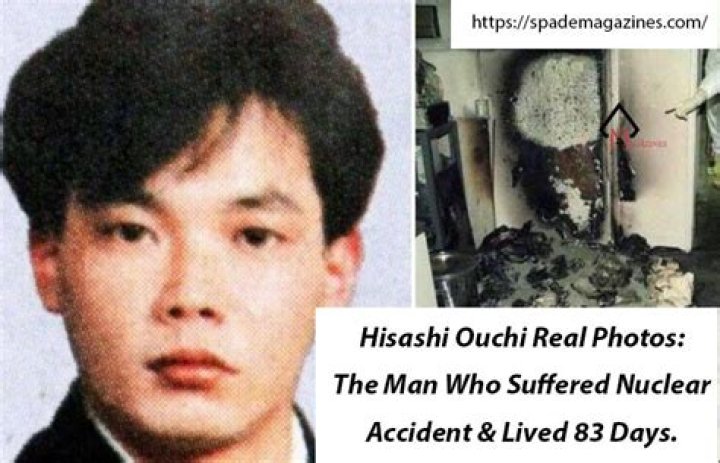 Comprehensive Guide To Real Photos Of Hisashi Ouchi