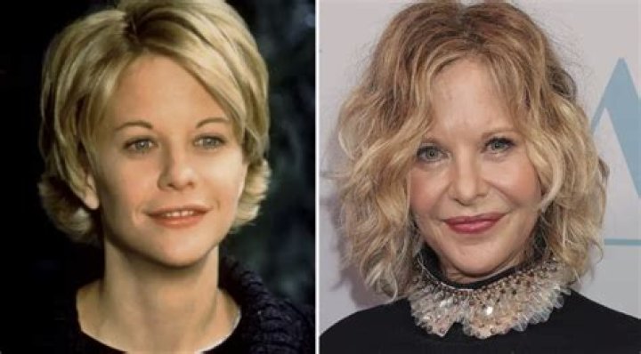 Did Plastic Surgery Ruin Actor Meg Ryans Career?
