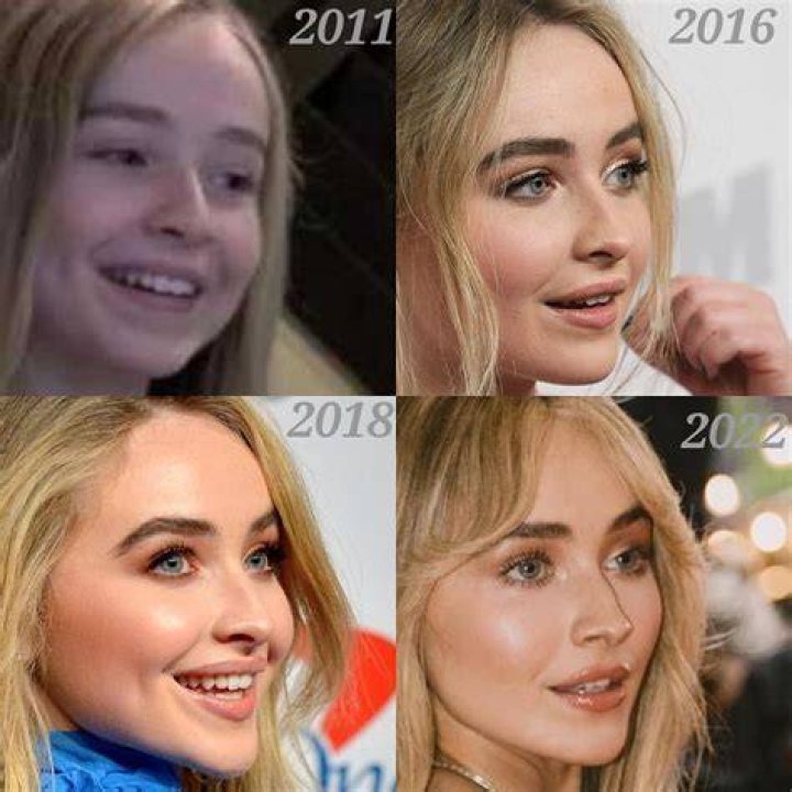Did You Know: Sabrina Carpenter Lip Fillers