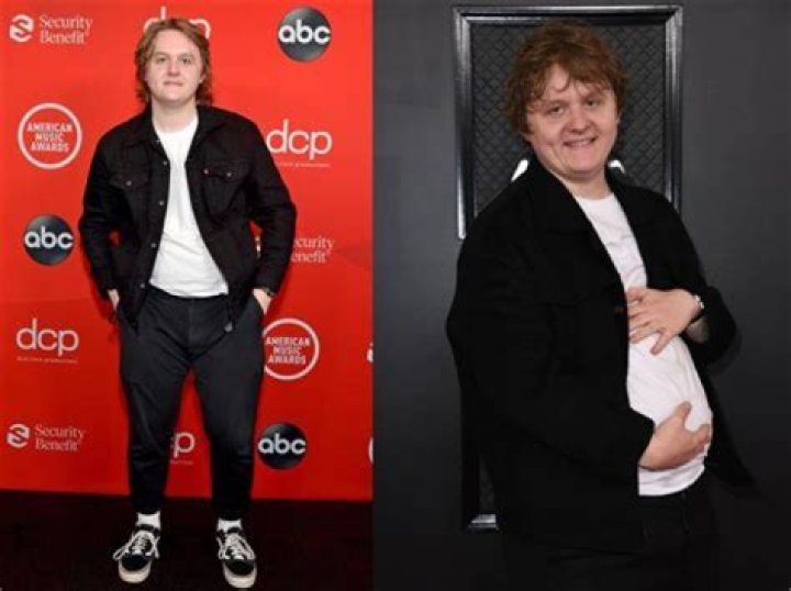 Discover Lewis Capaldi's Height: Uncover The Stats Behind The Scottish Singer