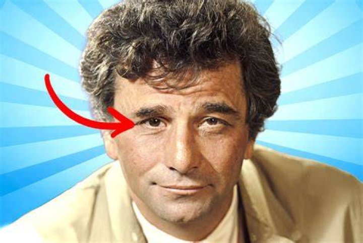 Discoveries About Male Actors With Lazy Eyes