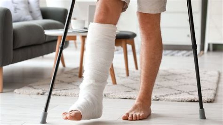 Driving With A Broken Right Foot: Is It Possible?
