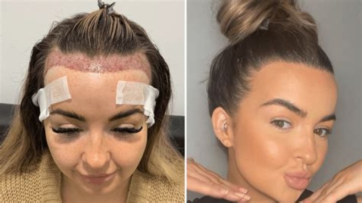 Experience Transformation With Hairgrowth X Today