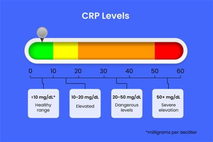 Explore The Normal Range Of C-Reactive Protein (CRP)