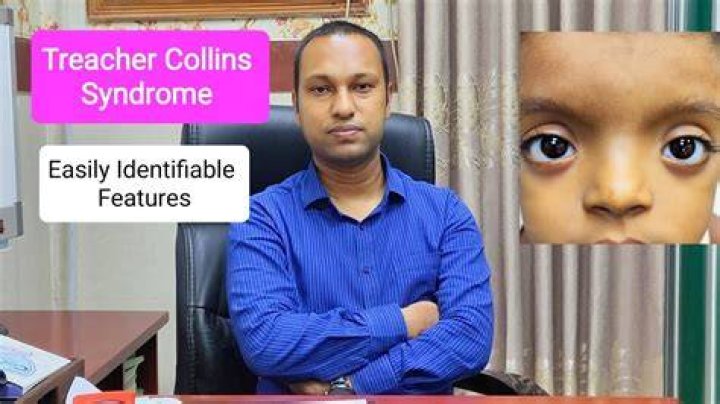 Female Celebrities With Treacher Collins Syndrome