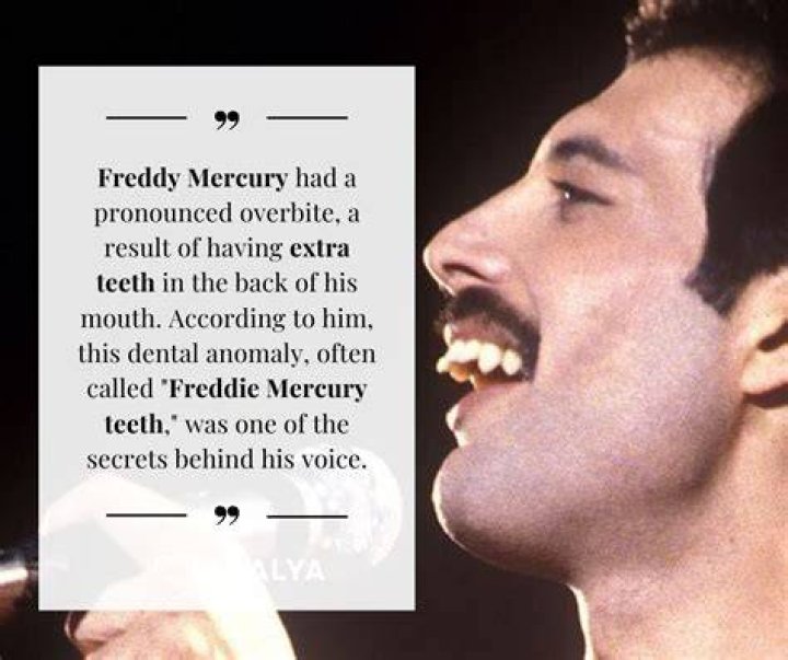 Freddie Mercury's Remarkable Teeth: A Unique Story Of Dental Distinction