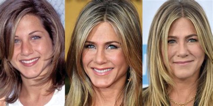 Has Jennifer Aniston Had Plastic Surgery?