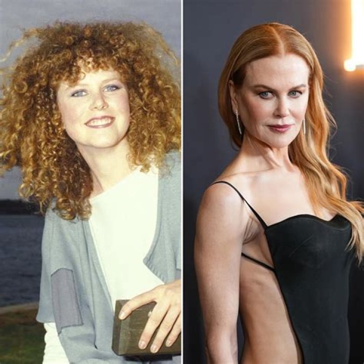 Has Nicole Kidman Had Cosmetic Surgery? Exploring The Rumors