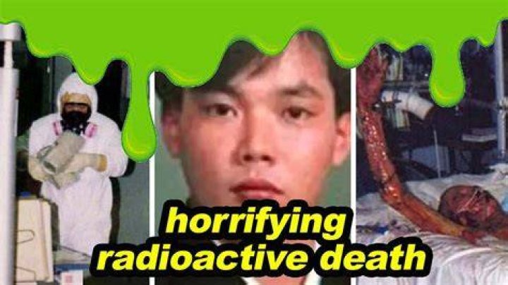 Hisashi Ouchi's Final Days: A Heartbreaking Tragedy