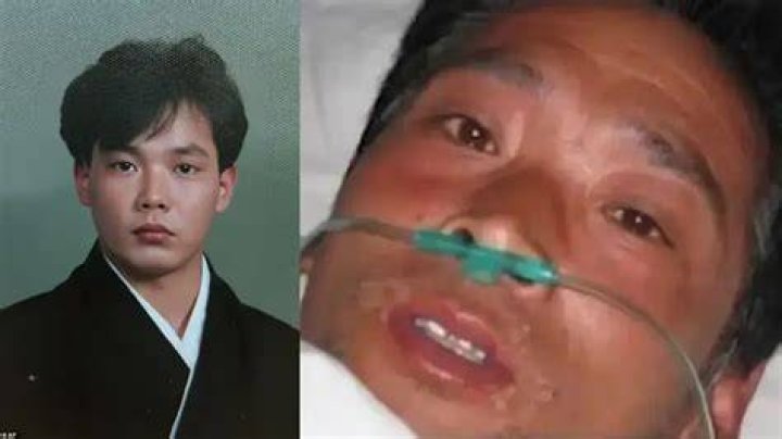 Hisashi Ouchi's Harrowing Body Images: A Medical Mystery Unveiled