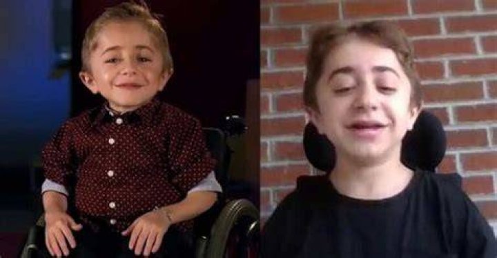 How Old Is Kaleb? Discover His Age At Shriners Hospital