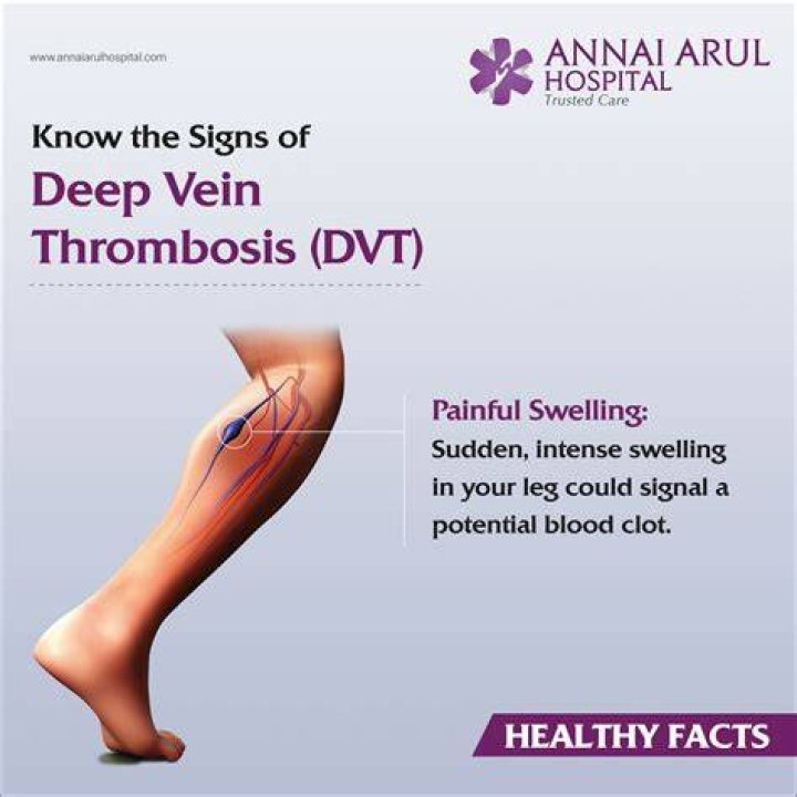 ICD-10 Code For Deep Vein Thrombosis (DVT): Know The Signs