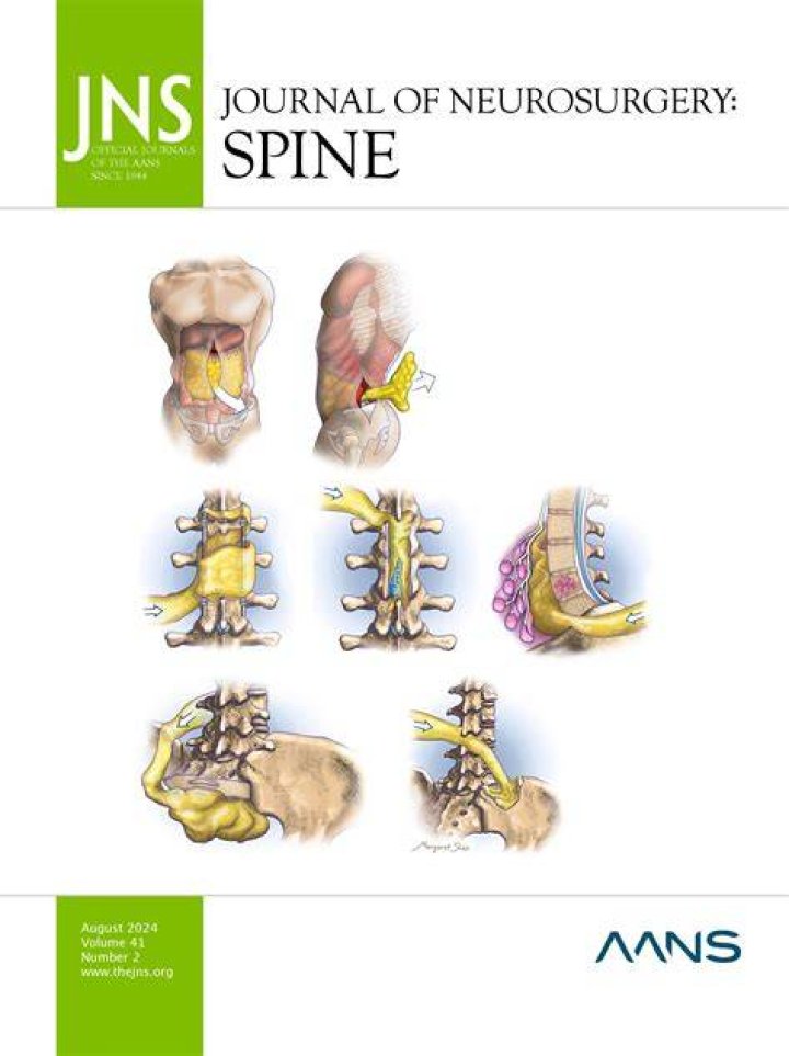 Its Impact On The Spine