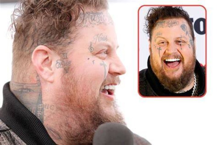 Jelly Roll Teeth: An Exquisite Guide To Their Origin And Effect