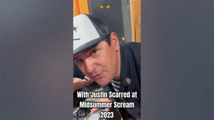 Justin's Scarred Age: Overcoming Adversity