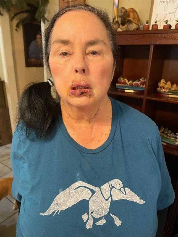 Kay Robertson's Health Struggles: A Journey To Recovery