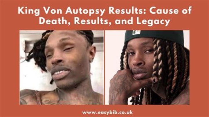 King Von Autopsy Photo Surfaces