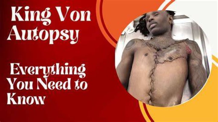 King Von Autopsy Report Released