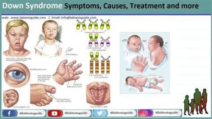 Learning About Hippos With Down Syndrome: A Comprehensive Guide
