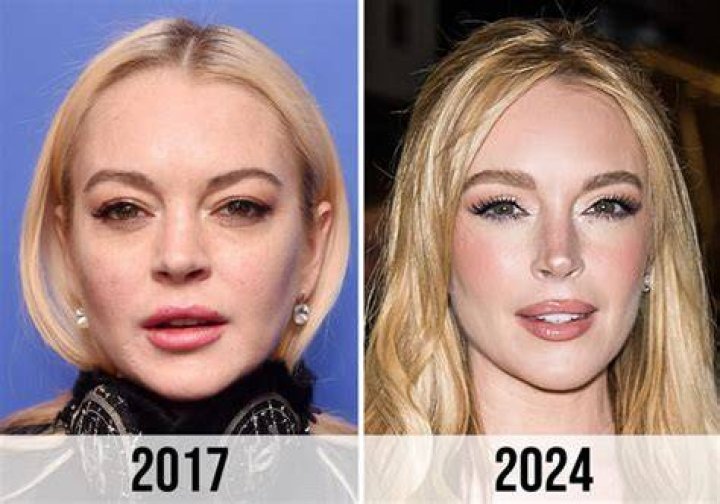 Lindsay Lohan Breast Surgery Gets Candid About Enhancements