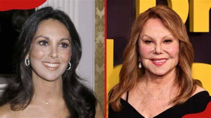 Marlo Thomas' Cosmetic Surgery Journey