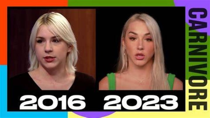 Mikhaila Peterson's Transformation: A Before-and-After Look At Plastic Surgery