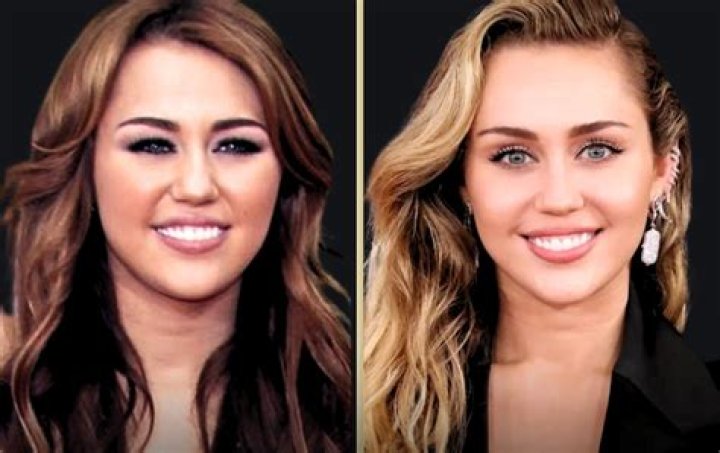 Miley Cyrus Has Vocal Surgery And Is Forbidden To Speak