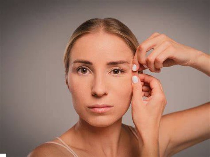 Non-Surgical Jelly Roll Botox: A Solution For Saggy Jowls