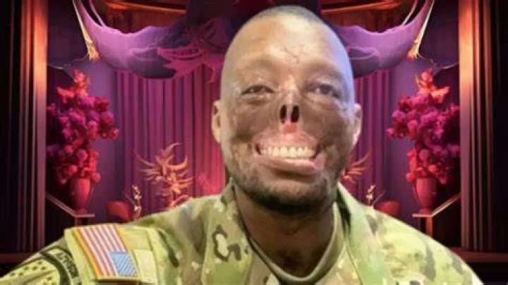 Randy Adams Face Accident