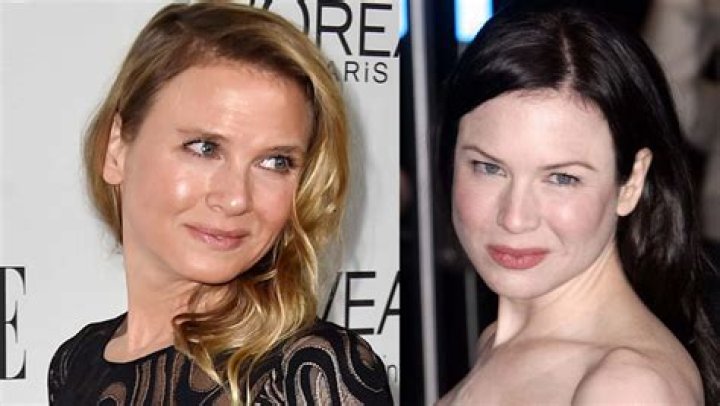Renee Zellweger Now And Then