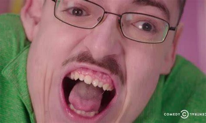 Ricky Berwick's Disease: A Comprehensive Guide