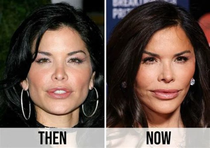 Rosemary Sanchez Surgery: Transformation Revealed