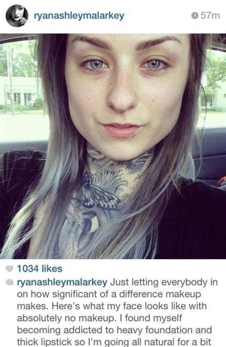 Ryan Ashley Malarkey's Plastic Surgery Journey