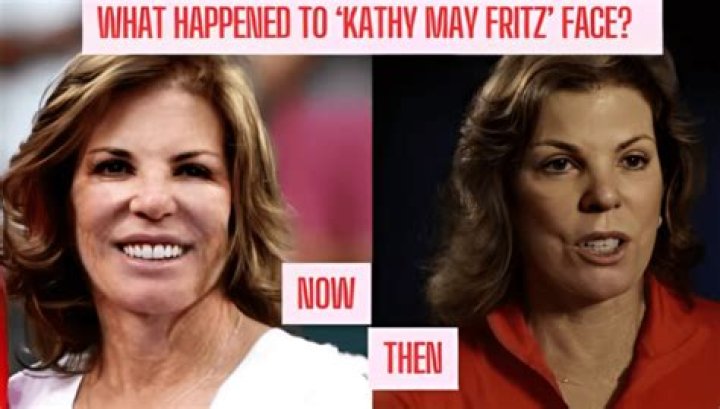Striking Image Of Kathy May Fritz's Stunning Face