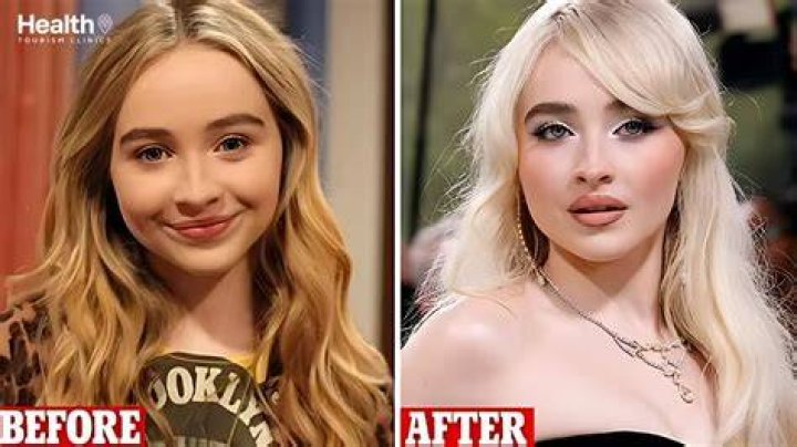 Surprising Sabrina Carpenter Face Transformation: Before And After