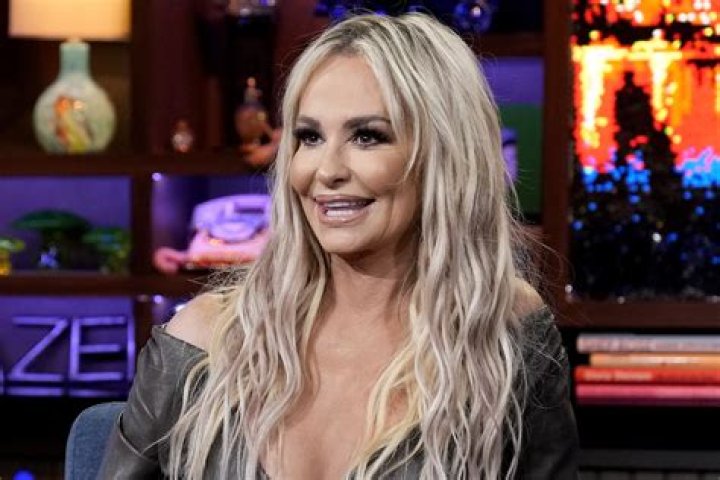 Taylor Armstrong releases photos of her abuse to ET (warning) ·