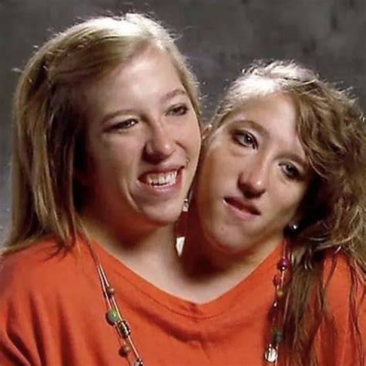 The Extraordinary Lives Of Conjoined Twins Brittany And Abby Hensel